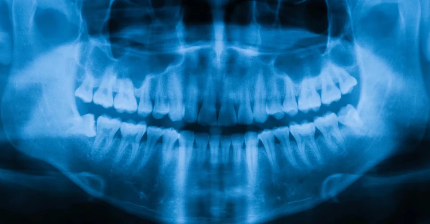 dents os in blog